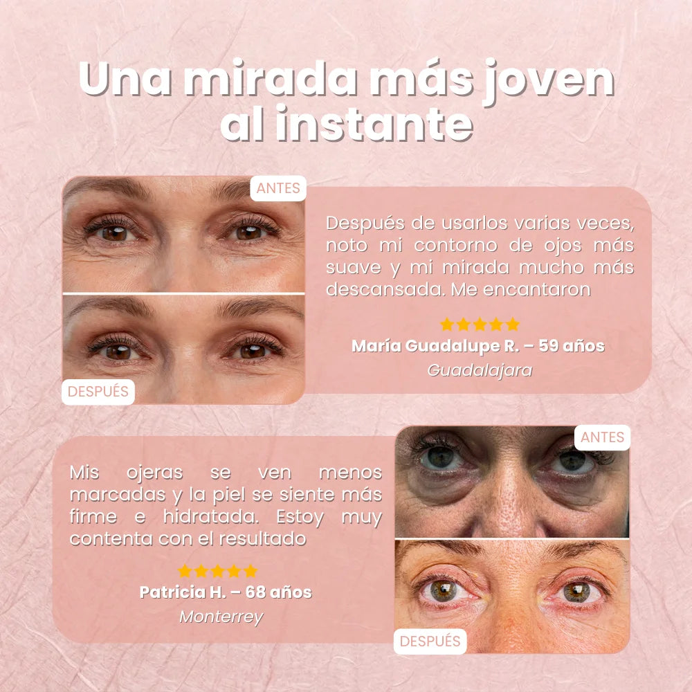 Parches MicroLift™ | Borra Ojeras, Bolsas y Arrugas en 2 Horas