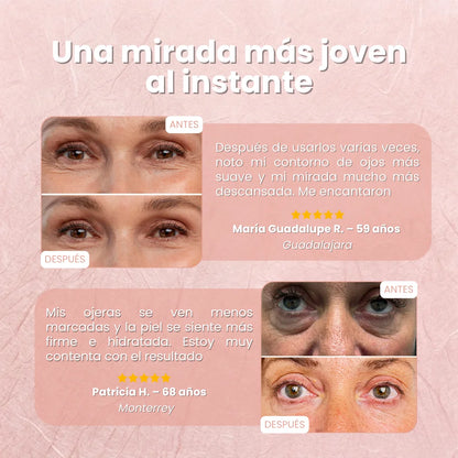 Parches MicroLift™ | Borra Ojeras, Bolsas y Arrugas en 2 Horas